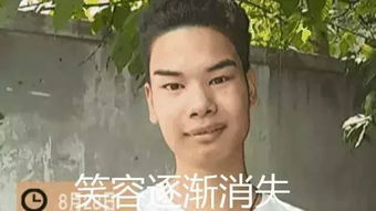  植发太太太太贵这份秃头少女自救指南收好