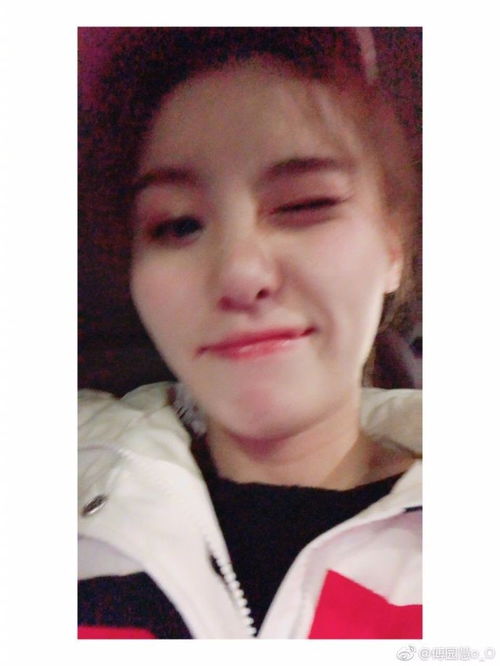  泥石流女神傅园慧整牙后成高配版刘诗诗,看来baby杨幂没整容