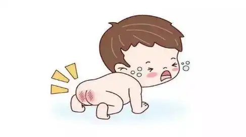  4个方法预防宝宝红屁股,宝妈们记得收藏哦
