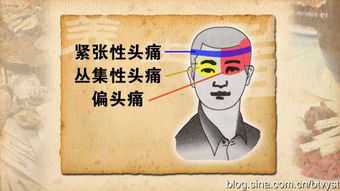 头痛类型图片表情包头痛