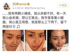  实用贴学不来大美刘涛大方晒长痘,就用完美遮瑕魔法变走它