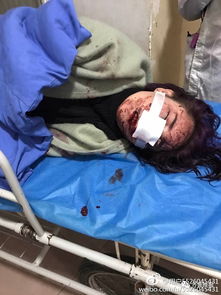  女子丽江游玩遭暴打,被用碎酒瓶划脸无法接受被毁容事实,已经写好遗书...
