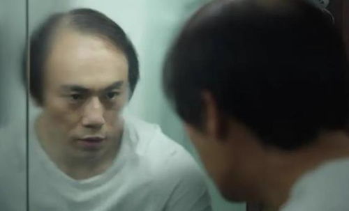 孙亚龙秃头表情包秃顶