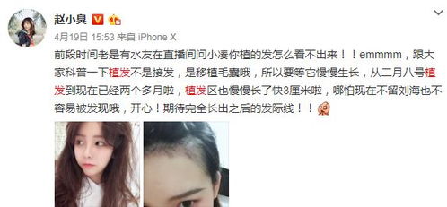  继孙亚龙之后,张大仙也秃了,人均秃头的时代要来了
