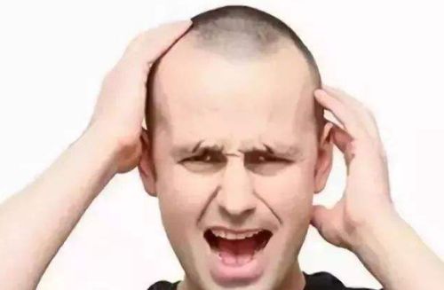  种头发手术对脱发患者本身有什么要求,种头发的前提是什么