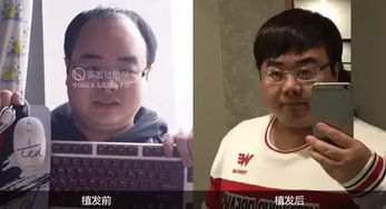  不管你脱发再严重,试试这个方法总没错