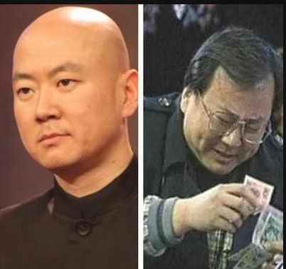  秃头一时爽,一直秃头一直爽秃头地中海掉头发点这里