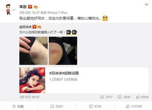  尴尬了范冰冰晒戏伤与大黑牛秀恩爱虐狗,却被痛批太矫情