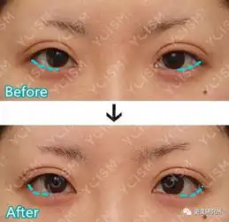 杨幂究竟做了啥,眼神竟然从刻薄犀利变温柔直男斩了 杨幂究竟做了啥,眼神竟然从刻薄犀利变温柔直男斩了