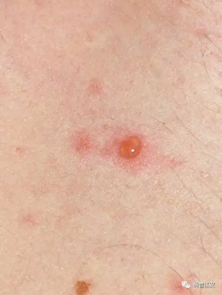 皮肤上这个包请安检 皮肤上这个包请安检